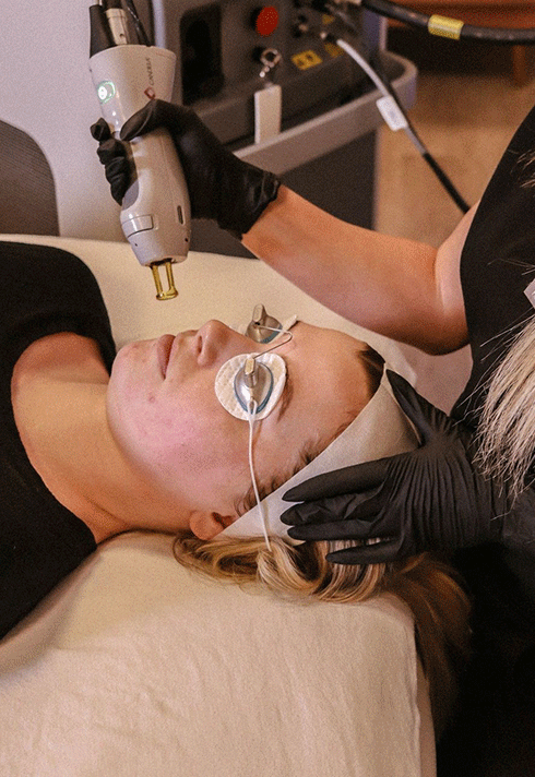 A lady receiving medical laser service on her skin performed by Medical Esthetics Program Grad Cierra Evans